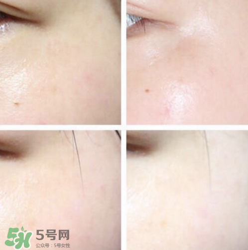 城野醫(yī)生377孕婦可以用嗎？城野醫(yī)生377孕婦用好嗎？