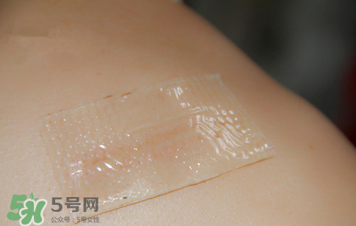 仙卡疤痕貼有用嗎？仙卡疤痕貼效果怎么樣？