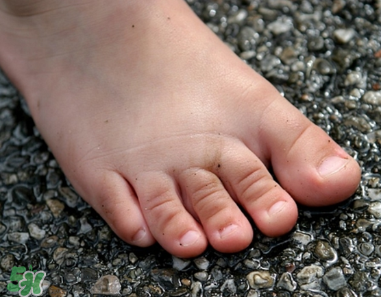 日本灰指甲藥水有用嗎？日本灰指甲藥水評(píng)測