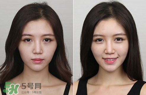 蘋果肌怎么化？蘋果肌究竟哪里好？