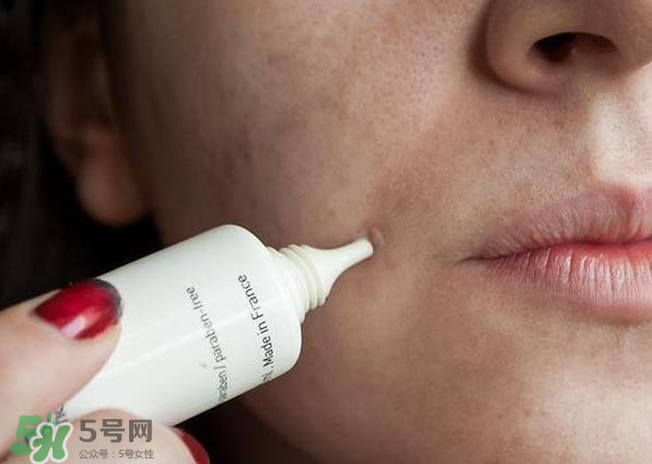 痤瘡的分類 痤瘡的護(hù)理原則 痤瘡的分類 痤瘡的護(hù)理原則