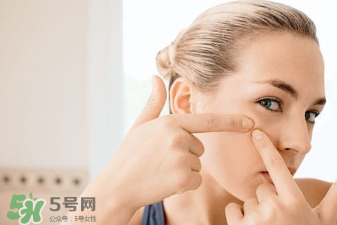 暗瘡可以擠壓?jiǎn)?？油性和骯臟肌膚會(huì)容易有暗瘡嗎？