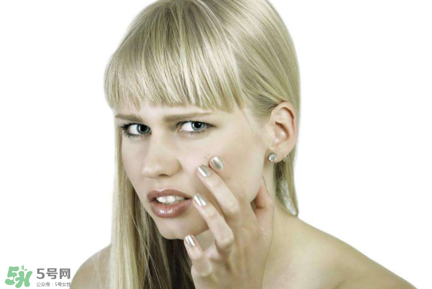 痤瘡和毛囊炎一樣嗎？痤瘡與毛囊炎區(qū)別