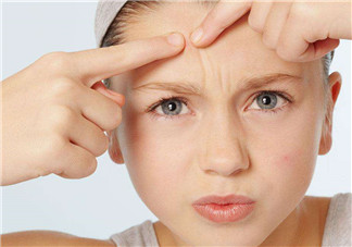 暗瘡可以擠壓?jiǎn)?？油性和骯臟肌膚會(huì)容易有暗瘡嗎？