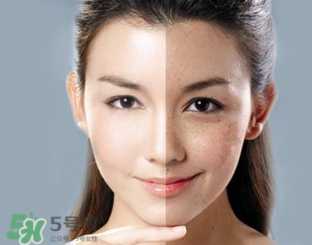 柿子葉凡士林多久祛斑 柿子葉祛斑有人用過(guò)嗎 柿子葉凡士林多久祛斑 柿子葉祛斑有人用過(guò)嗎