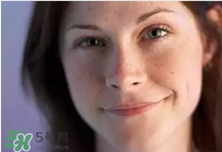 柿子葉凡士林多久祛斑 柿子葉祛斑有人用過(guò)嗎 柿子葉凡士林多久祛斑 柿子葉祛斑有人用過(guò)嗎