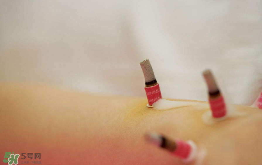 艾灸的時間多少為宜？艾灸后皮膚發(fā)癢是為什么？