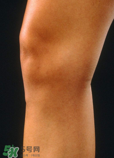 風(fēng)濕要做哪些檢查？風(fēng)濕要檢查哪些項(xiàng)目？