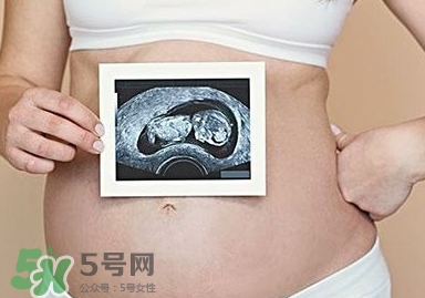 雙子宮可以上環(huán)嗎？雙子宮上環(huán)要注意哪些？