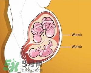 雙子宮是什么意思？雙子宮可以順產(chǎn)嗎？