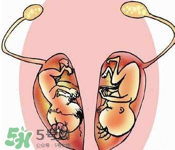 雙子宮對(duì)懷孕有影響嗎？雙子宮懷孕要注意什么？