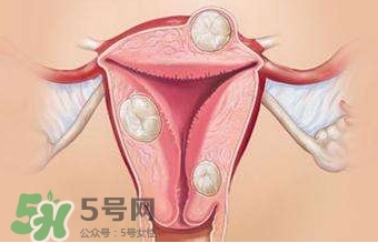 雙子宮可以上環(huán)嗎？雙子宮上環(huán)要注意哪些？