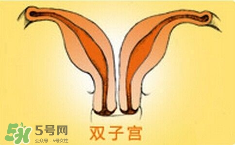 雙子宮是什么意思？雙子宮可以順產(chǎn)嗎？