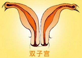 雙子宮是什么意思？雙子宮可以順產(chǎn)嗎？