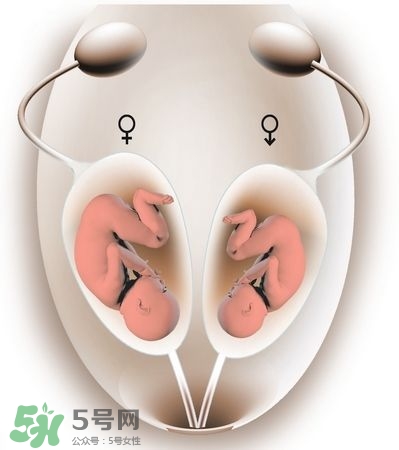 雙子宮對(duì)懷孕有影響嗎？雙子宮懷孕要注意什么？