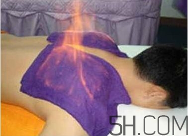 火療真的能治病嗎？火龍液的功效與作用