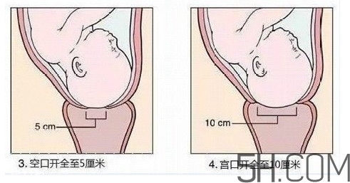 內檢是什么感覺？內檢有男醫(yī)生嗎？