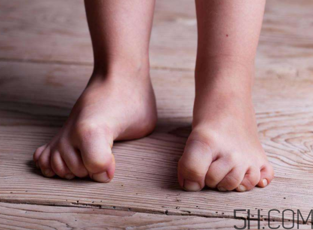 腳氣會通過床單傳染嗎？腳氣會傳染給嬰兒嗎？