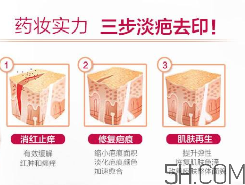 ISDIN怡思丁祛疤膏怎么用？ISDIN怡思丁祛疤膏使用說(shuō)明