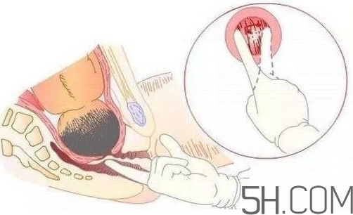 內檢是什么感覺？內檢有男醫(yī)生嗎？