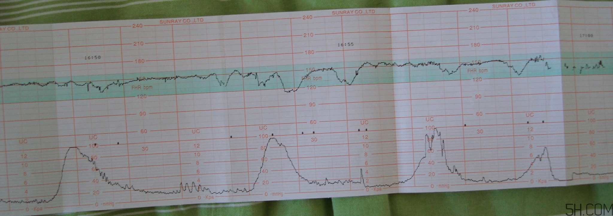 為什么要做胎心監(jiān)護(hù)？孕婦做胎心監(jiān)護(hù)有什么用？