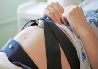 胎心監(jiān)護(hù)圖怎么看？胎心監(jiān)護(hù)多少錢？