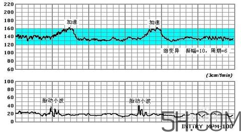 為什么要做胎心監(jiān)護(hù)？孕婦做胎心監(jiān)護(hù)有什么用？