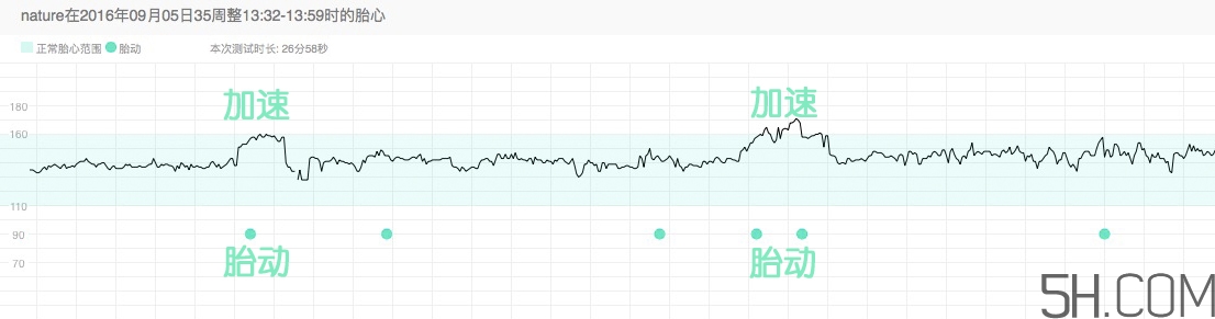 為什么要做胎心監(jiān)護(hù)？孕婦做胎心監(jiān)護(hù)有什么用？