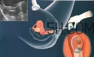 試管嬰兒有什么風(fēng)險？試管嬰兒長大后的弊端