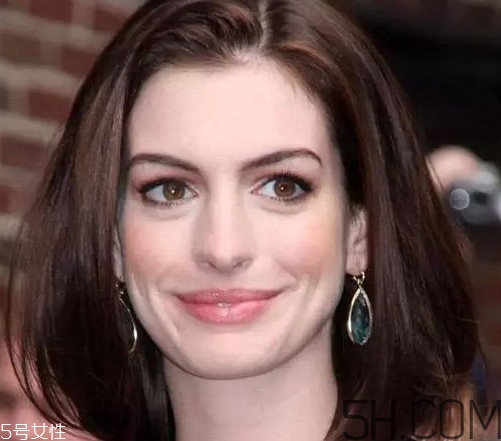 頭虱和頭皮屑怎么區(qū)分？頭虱是怎樣生成的