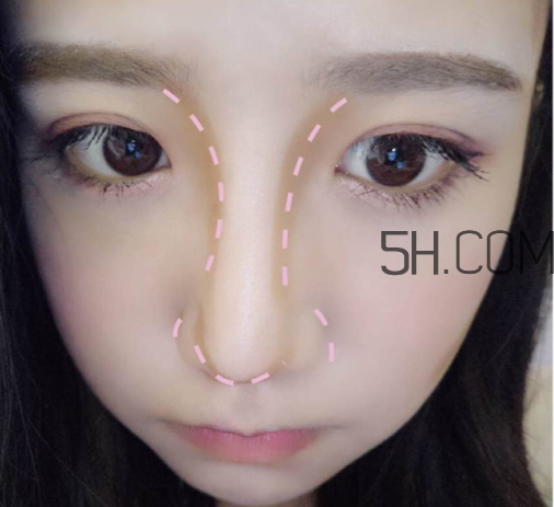 恒芳修容棒好用嗎？恒芳修容棒怎么樣？