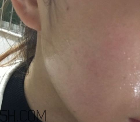 新生活國際玻尿酸補水面膜怎么樣？多少錢？