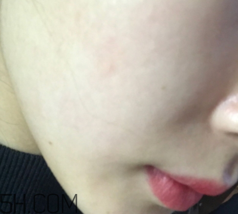 新生活國際玻尿酸補水面膜怎么樣？多少錢？