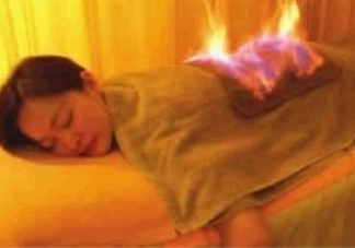 火療能治婦科病嗎？火療能去濕氣嗎