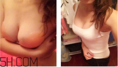 胸貼買哪種比較好 胸貼哪種材質的好