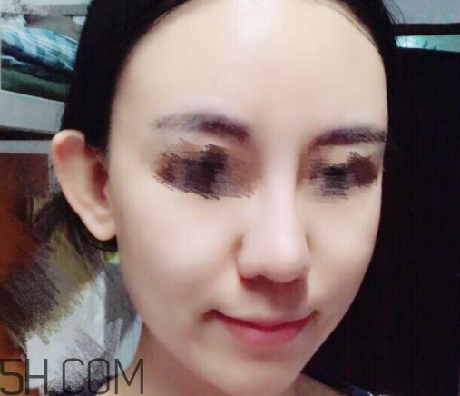 京潤珍珠玻尿酸面膜怎么樣？多少錢？