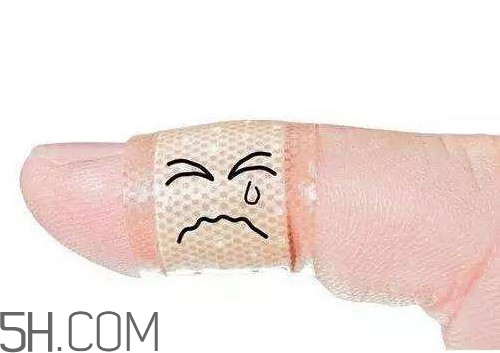 創(chuàng)可貼的膠怎么去除？創(chuàng)口貼哪些傷口不能用