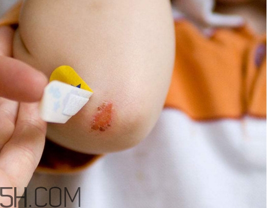 創(chuàng)可貼有消炎作用嗎？一張創(chuàng)可貼能用多長時(shí)間