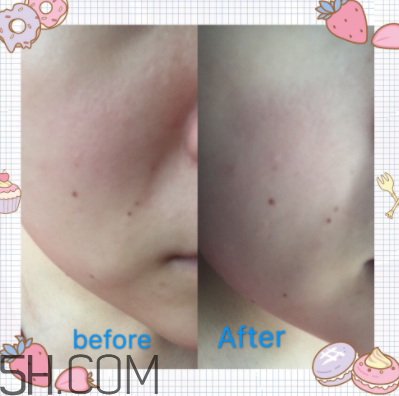 歐珀萊臻白多效角質(zhì)調(diào)理肌底液怎么樣？好用嗎？