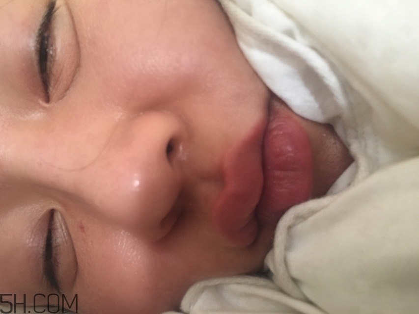 臉上有痘痘怎么化妝_臉上有痘痘怎么遮蓋 臉上有痘痘怎么化妝_臉上有痘痘怎么遮蓋