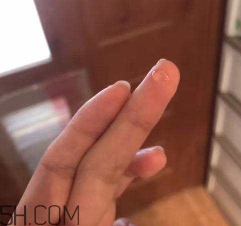 倍舒痕可以去痘印嗎？倍舒痕能涂在痘痘上嗎？