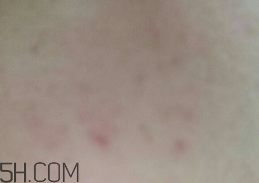 aox suaox祛痘原液怎么樣？多少錢？