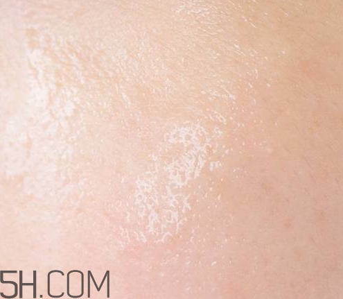 esthe dew爽膚水哪個顏色好？esthe dew化妝水不同顏色區(qū)別