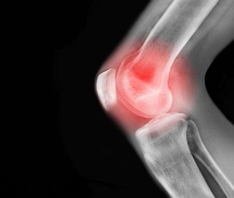 關(guān)節(jié)炎能吃螃蟹嗎？關(guān)節(jié)炎能吃海鮮嗎？