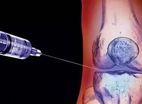 關節(jié)炎打封閉針好嗎？關節(jié)炎打封閉針有副作用嗎？