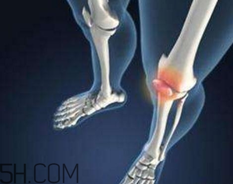 關節(jié)炎打封閉針好嗎？關節(jié)炎打封閉針有副作用嗎？