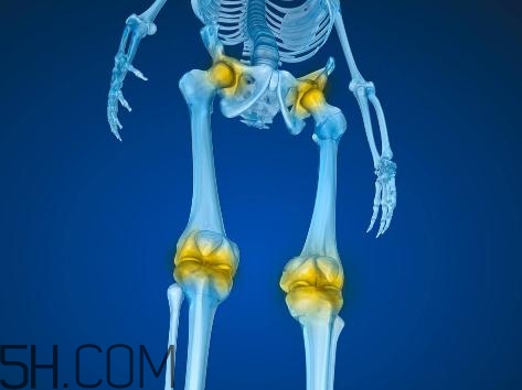 關(guān)節(jié)炎積液什么癥狀？關(guān)節(jié)炎積水怎么治療？