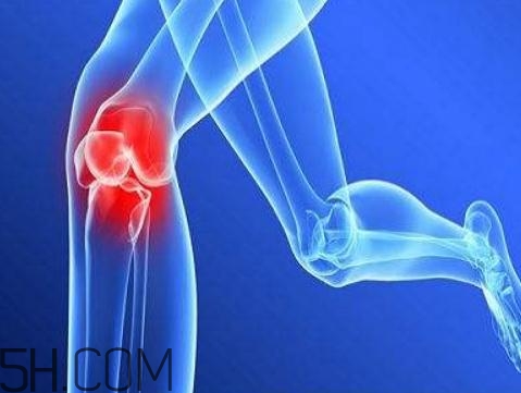 關(guān)節(jié)炎需要補(bǔ)鈣嗎？關(guān)節(jié)炎補(bǔ)鈣有用嗎？