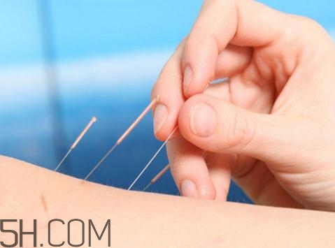 關(guān)節(jié)炎需要補(bǔ)鈣嗎？關(guān)節(jié)炎補(bǔ)鈣有用嗎？