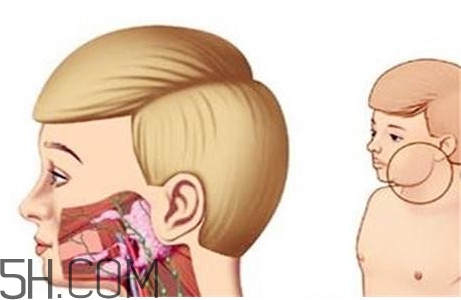 淋巴癌最嚴重時會成什么樣子？淋巴瘤能治好嗎